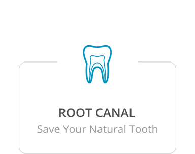 Root Canal 1